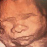 A picture of a baby with a blurry image.