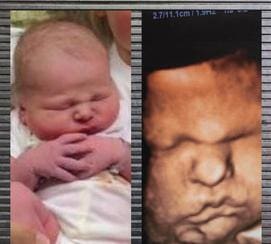 A baby is shown in the picture next to an image of it.