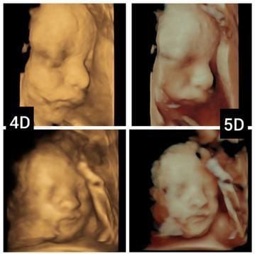 A series of four images showing the same patient 's face.