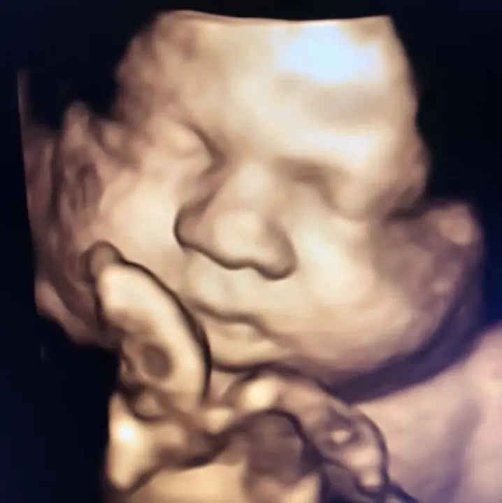 A blurry image of a baby 's face and head.