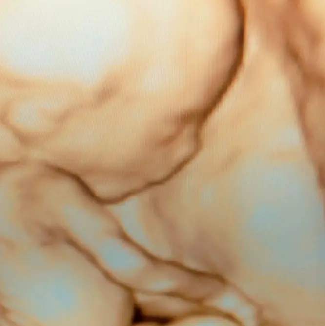 A close up of the skin on a woman 's body.