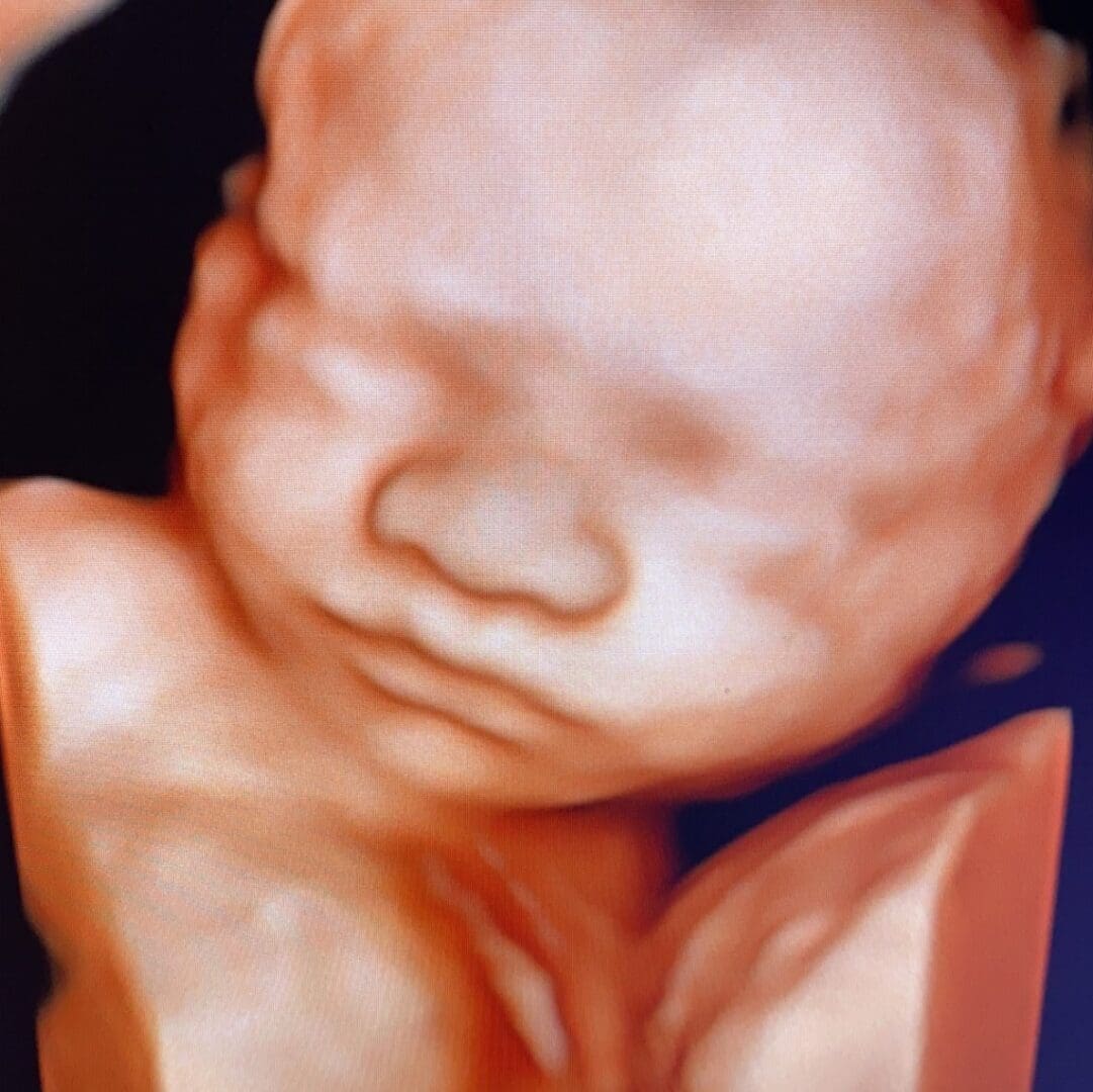 A blurry picture of a baby 's head and face.