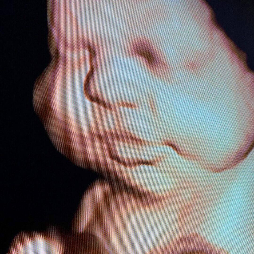 A blurry picture of a baby 's face.