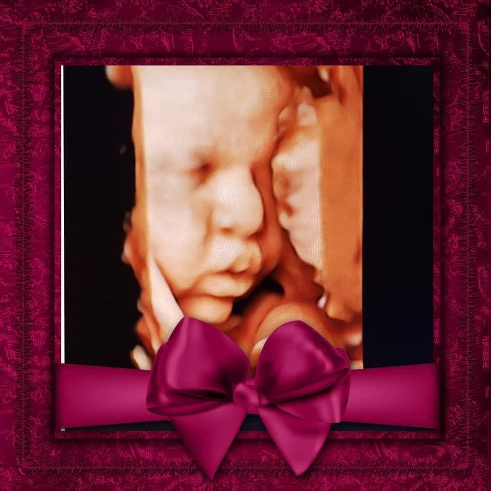 A baby is in a frame with a bow.