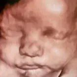 A baby is shown in the picture.